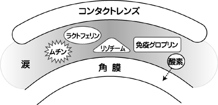 コンタクトレンズと角膜とその間の涙の成分(ムチン、ラクトフェリン、リゾチーム、免疫グロブリン)についての図